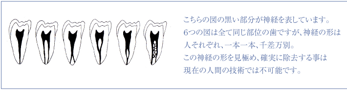 歯の神経の図